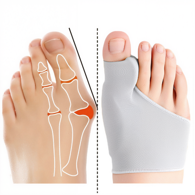 Teenseparator gelpad voor voetpijn met zachte gel, biedt comfort en steun voor bunions. Discreet, duurzaam en veelzijdig.