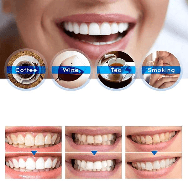 "Tanden bleken essentie met heldere vloeistof in transparante flacon voor stralend witte tanden zonder gevoeligheid."