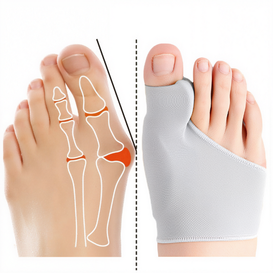 Teenseparator gelpad voor voetpijn met zachte gel, biedt comfort en steun voor bunions. Discreet, duurzaam en veelzijdig.